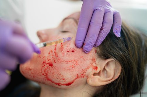 PLATELET-RICH PLASMA COURSE (PRP TRAINING)