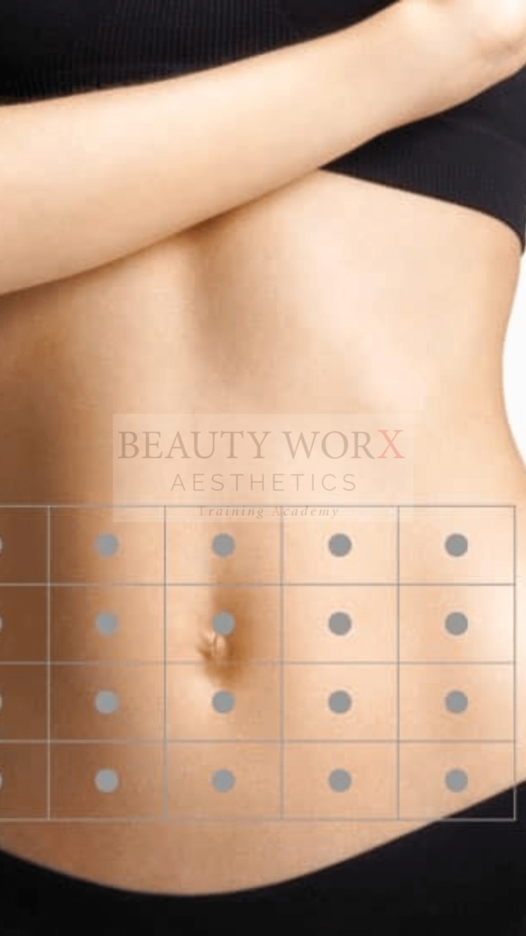 PROFHILO BODY TRAINING Beauty Worx Aesthetics