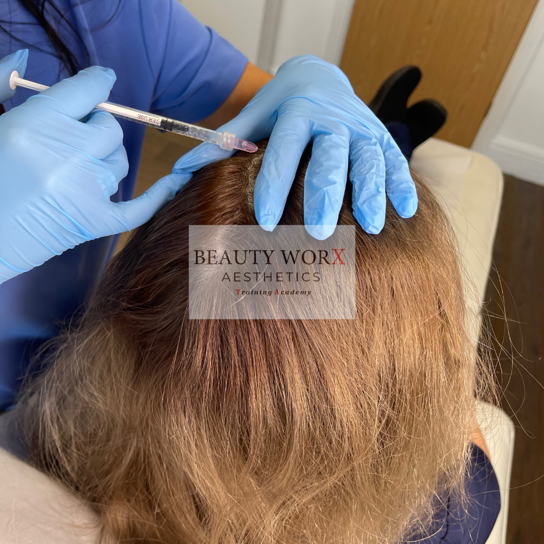 HAIR LOSS MESOTHERAPY Beauty Worx Aesthetics