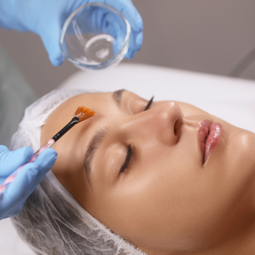 CHEMICAL PEEL
